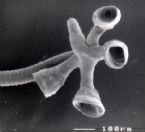 scolex of Pseudanthobothrium purtoni (Cestoda: Tetraphyllidea: Phyllobothriidae: