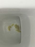 What is this? Mucus / Candida?