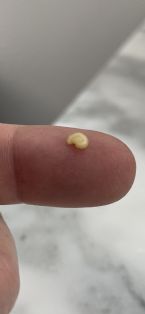 Worm Egg