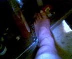 Leg July 029