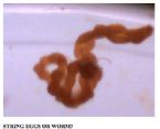 worm eggs ... (Click to enlarge)