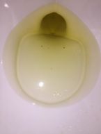 BLACK SPOTS AND WHITE STRING IN URINE - STRUGGLING WITH CONSTANT BODY ODOR - CAUSE?