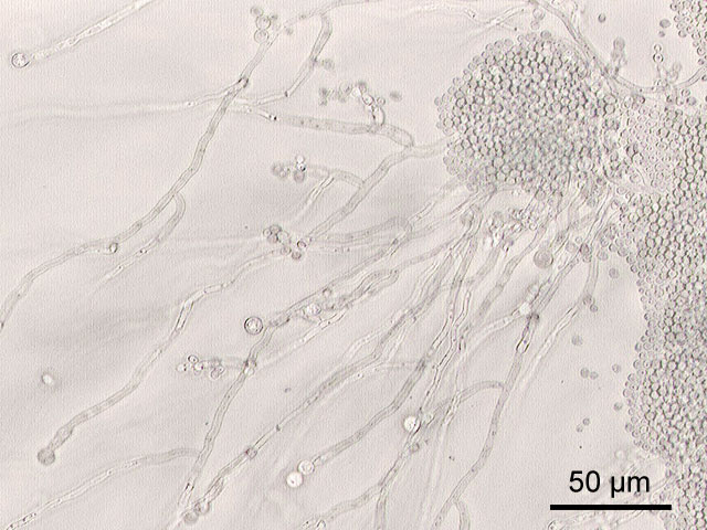 //www.curezone.org/upload/_C_Forums/Candida/Candida_albicans_mycelial_growth.jpg