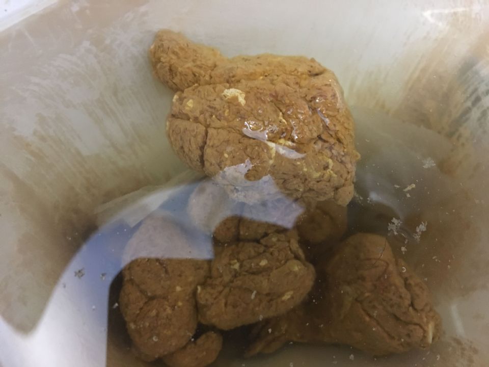 White Coating On My Daughters Poop R Gastroenterology