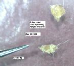 2 yeast balls sprout fungal filaments/ with needl ... (Click to enlarge)