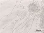 Candida albicans mycelial growth