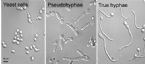 Candida Albicans from Yeast to Hyphae