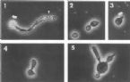 mycelial candida