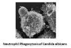 neutrophil phagocytosis of candida albicans ... (Click to enlarge)