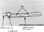 yeast5