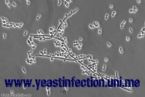 yeast infection virus