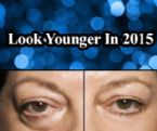 Are You Embarrassed By Dark Circles,Under-Eye Bags & Wrinkles?  InstantlyAgeless.UK 