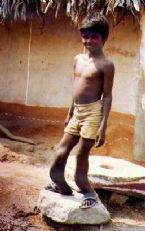 skeletal fluorosis caused by fluoride in water supply