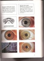 iridology 001