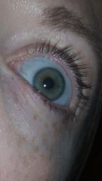 picture of my eye