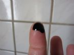 Lanolin iodine drop on fingertip