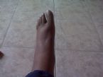 foot1