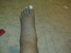 foot3