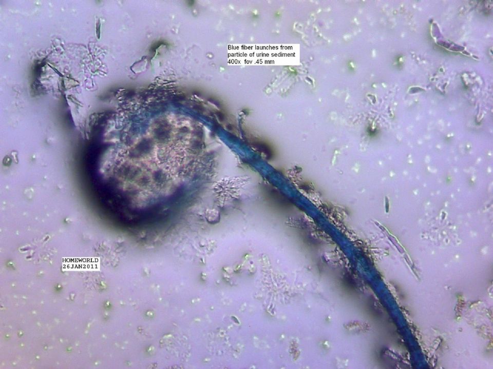 //www.curezone.org/upload/_M_Forums/Morgellons/FHW/Urine/hatching_fiber_5_3x4.jpg