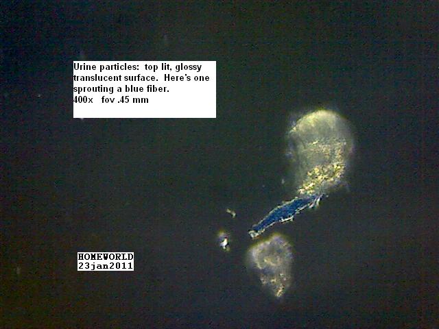 //www.curezone.org/upload/_M_Forums/Morgellons/FHW/Urine/uripart_sprouts_blue_23jan11.jpg