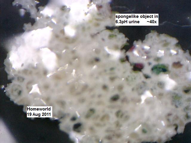 //www.curezone.org/upload/_M_Forums/Morgellons/FHW/Urine/urisponge19aug11.jpg