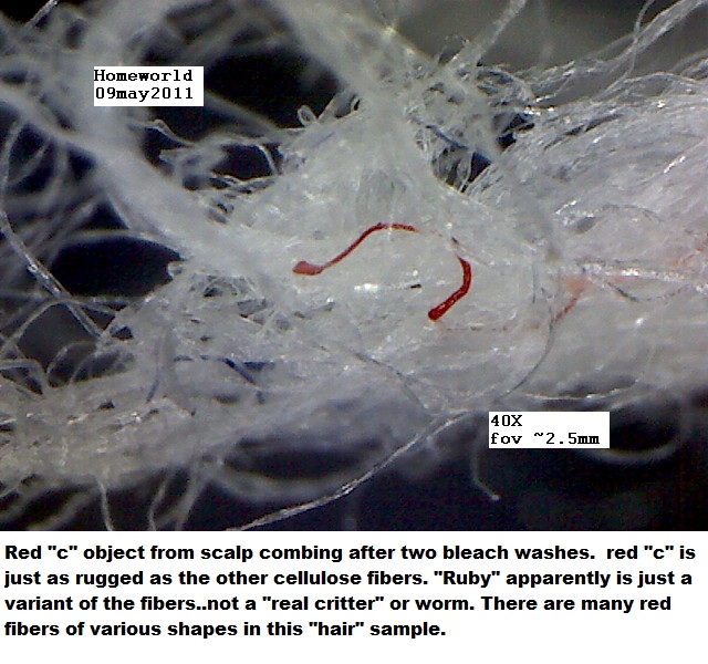 //www.curezone.org/upload/_M_Forums/Morgellons/FHW/hair_and_scalp/red_c_9may11.jpg