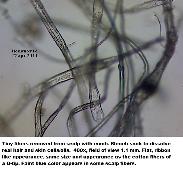 //www.curezone.org/upload/_M_Forums/Morgellons/FHW/hair_and_scalp/scalpfiber22apr11.jpg