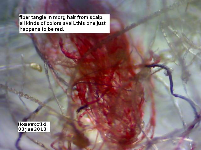 //www.curezone.org/upload/_M_Forums/Morgellons/FHW/morghairtangle8jun10.jpg