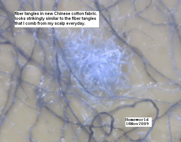 //www.curezone.org/upload/_M_Forums/Morgellons/FHW/pajama_tangles_nov09.jpg