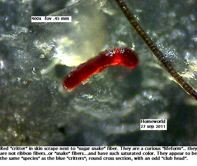 //www.curezone.org/upload/_M_Forums/Morgellons/FHW/red_blue_worms/redfiber27sep11.jpg