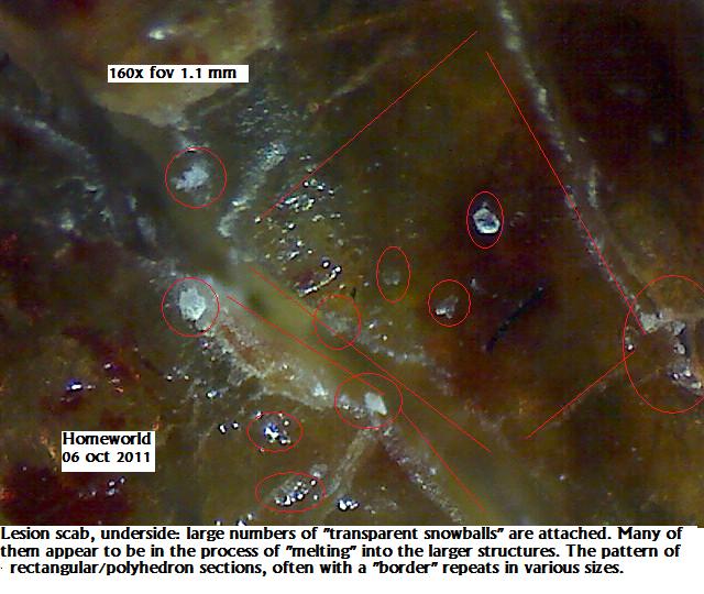 //www.curezone.org/upload/_M_Forums/Morgellons/FHW/scabs/bigsquare6oct11.jpg