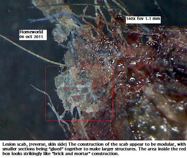 //www.curezone.org/upload/_M_Forums/Morgellons/FHW/scabs/brickscab6oct11.jpg