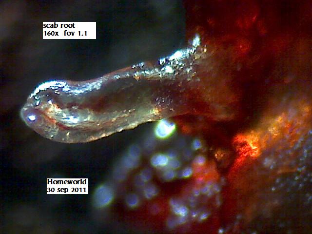 //www.curezone.org/upload/_M_Forums/Morgellons/FHW/scabs/scabroot30sep11.jpg