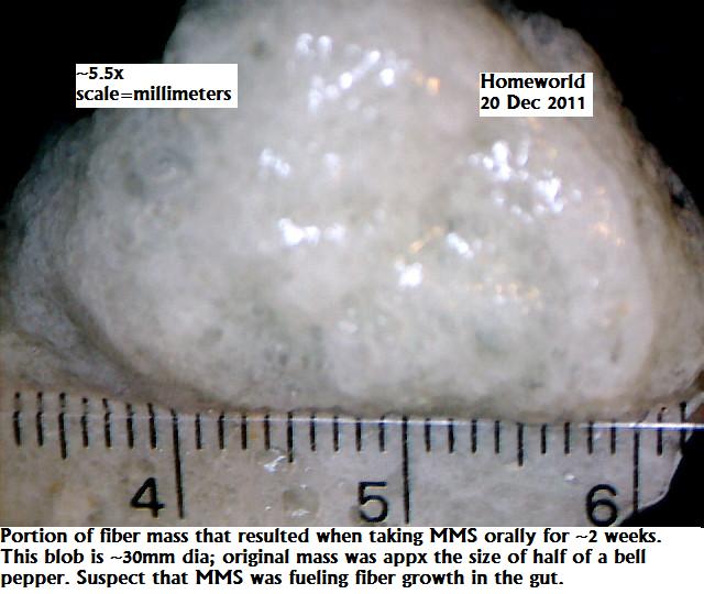 //www.curezone.org/upload/_M_Forums/Morgellons/FHW/stool/yarnball_20dec11.jpg