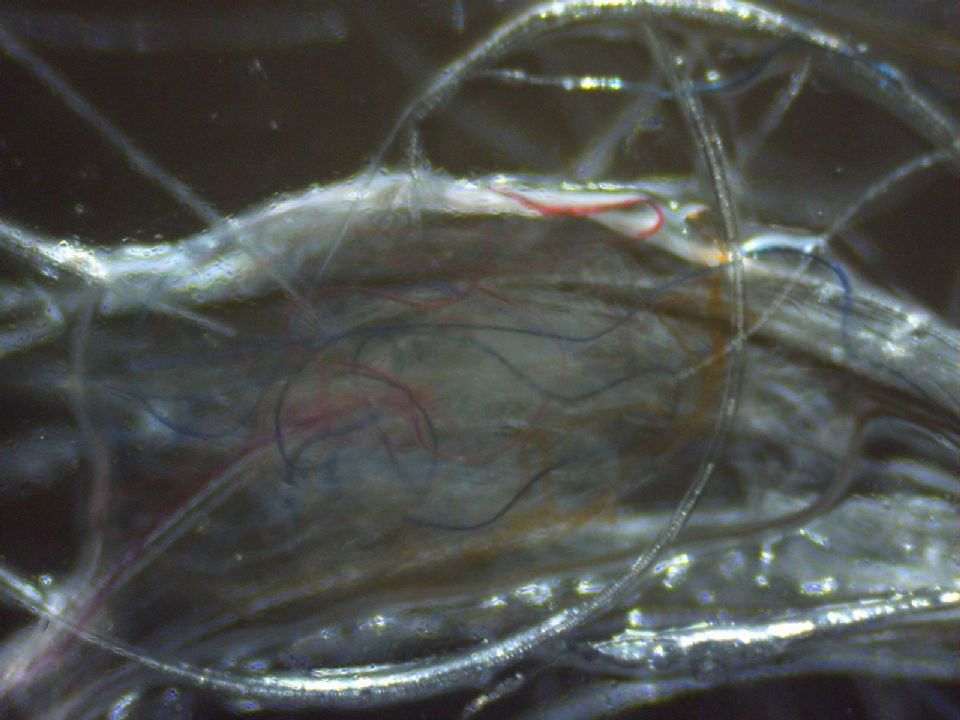 Tonight's fibers... Aren't they pretty? at Morgellons Disease Forum