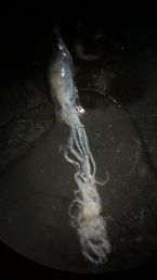 Morgellons Disease - Parasite or Jelly-Fish Like Lyme-Related Keratin Fibroblast Gone Wild?! ... (Click to enlarge)