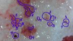 Morgellons/Parasites/Fungi/Protozoa...??? Pics from my skin