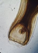 strongylus vulgaris