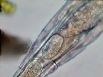 Rotifer embryo