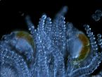 rotifers on polyps 1sm1