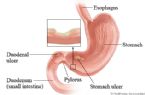 stomachDuodenum