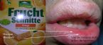 Cheilitis test ... (Click to enlarge)