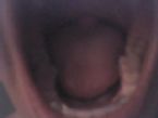 teeth