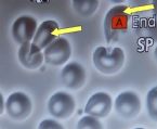 Blood cell sample august 201503