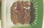 Mucoid Plaque. Photo from Dr. Jensen's  Bowel Man ... (Click to enlarge)