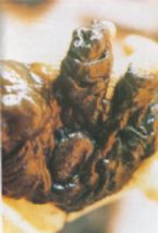 Mucoid Plaque. Photo from Dr. Jensen's  Bowel Man ... (Click to enlarge)