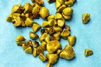 gallstones from the gallbladder ... (Click to enlarge)