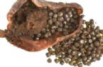 gallstones from the gallbladder ... (Click to enlarge)