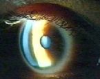 eye