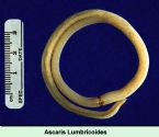 ascaris_lumbricoides ... (Click to enlarge)